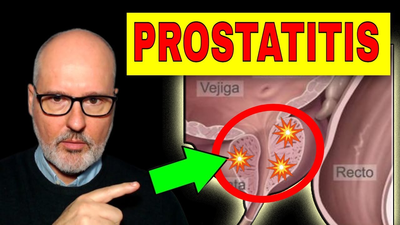 El mejor antibiótico para la prostatitis: descubre la opción más efectiva