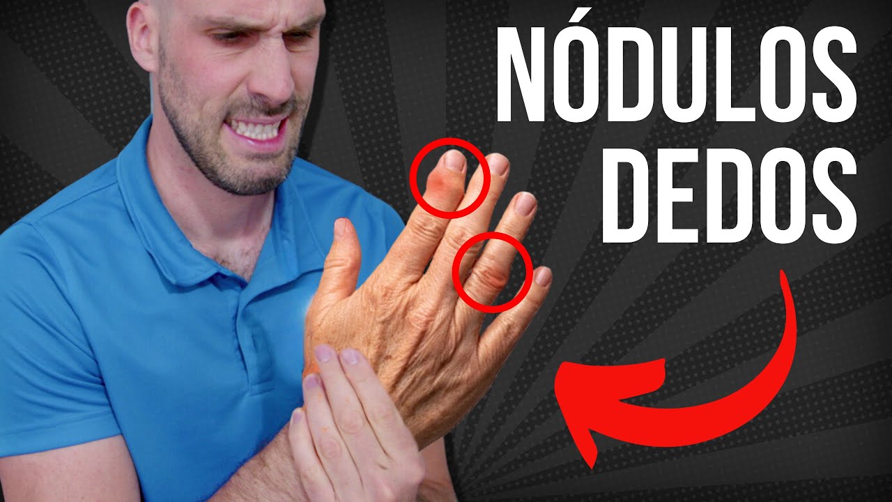 Descubre cómo aliviar el dolor de bolita en la falange del dedo de la mano